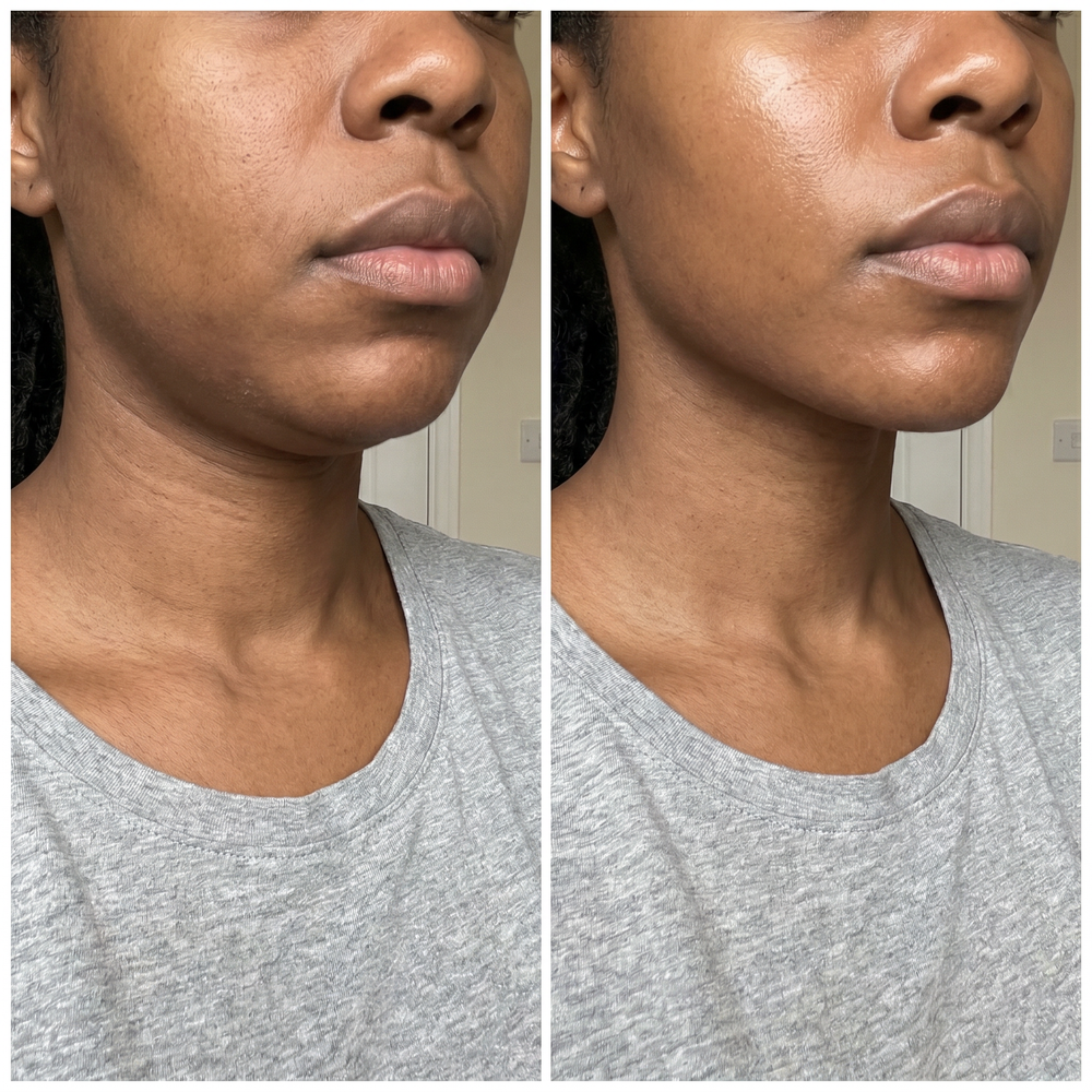 Before and after result shared by Monique Johnson